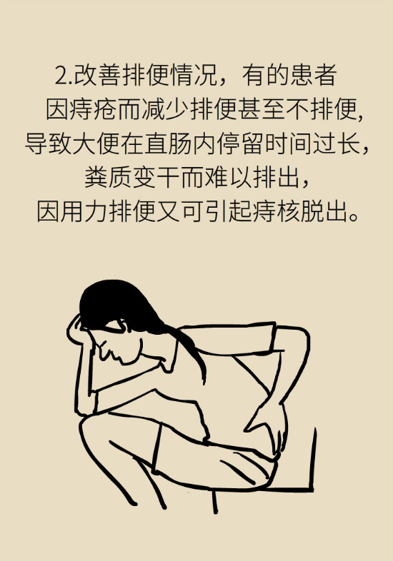 長“痔”如何久安？專家的建議來了