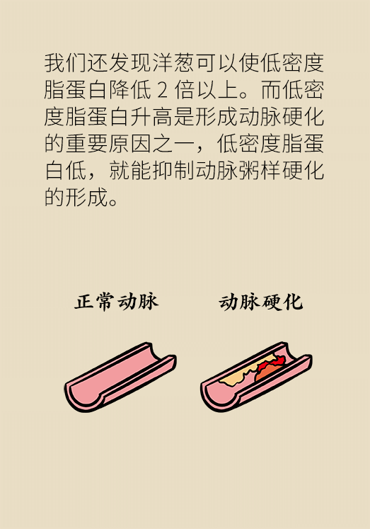 洋蔥可以預(yù)防動(dòng)脈硬化，是真的嗎？