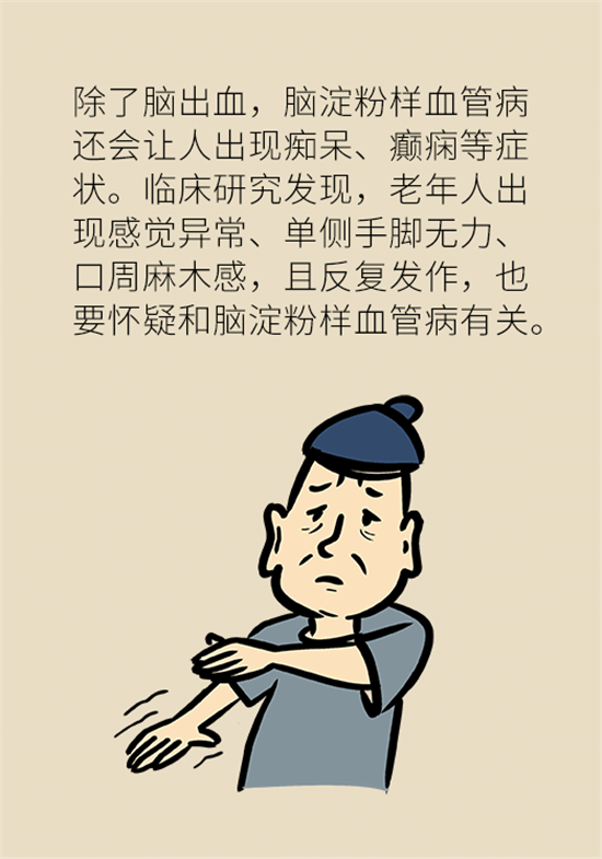 身體出現(xiàn)這些癥狀要小心，可能是腦出血發(fā)出的信號(hào)