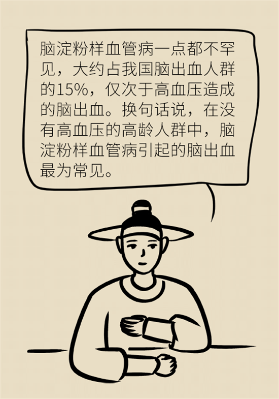 身體出現(xiàn)這些癥狀要小心，可能是腦出血發(fā)出的信號(hào)