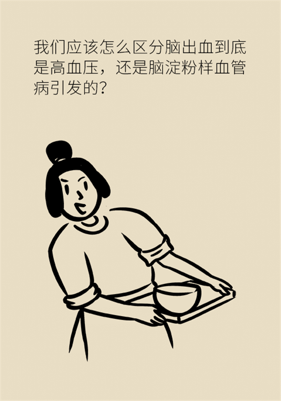 身體出現(xiàn)這些癥狀要小心，可能是腦出血發(fā)出的信號(hào)