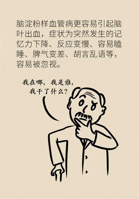 身體出現(xiàn)這些癥狀要小心，可能是腦出血發(fā)出的信號(hào)