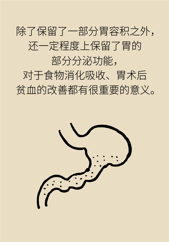 胃癌手術(shù)一定要全切胃？專家：視情況而定