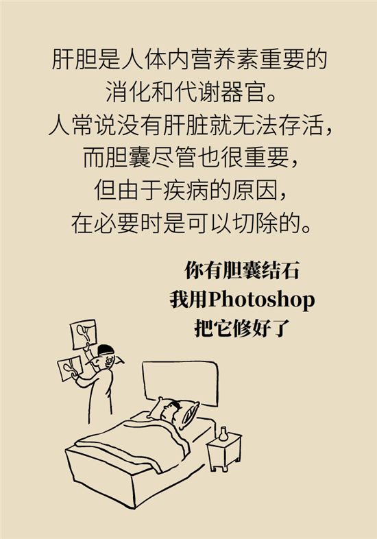 膽結(jié)石主要成分竟是膽固醇？預(yù)防它只需四個(gè)字
