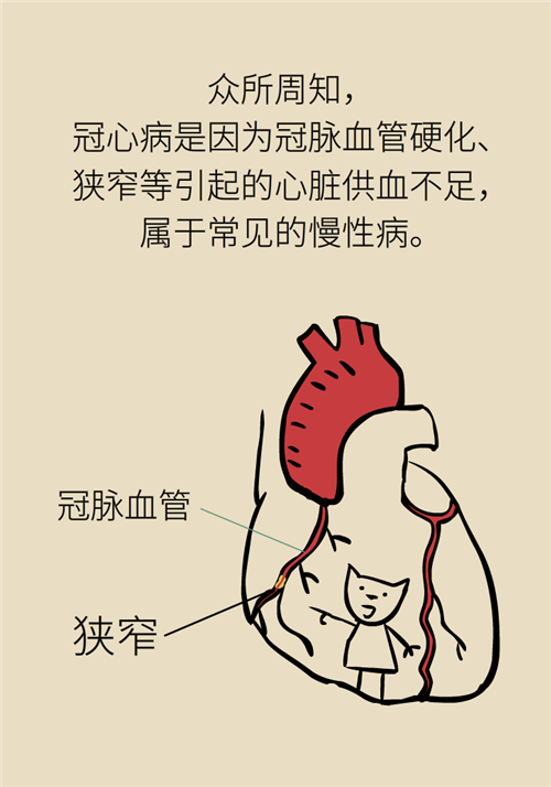 為什么裝完支架猝死風(fēng)險(xiǎn)還增高了？都是因?yàn)檫@些壞習(xí)慣
