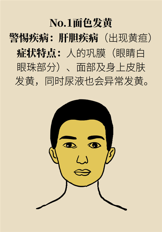 臉上的9個變化分別警示什么?。靠鞂︾R自查