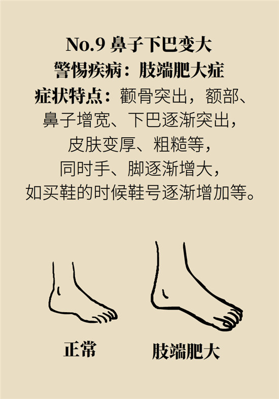 臉上的9個變化分別警示什么?。靠鞂︾R自查