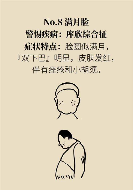 臉上的9個變化分別警示什么??？快對鏡自查