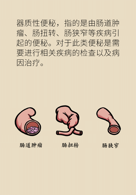 香蕉真的會(huì)緩解便秘嗎？