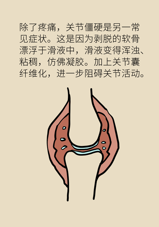 人老關(guān)節(jié)也會老嗎？