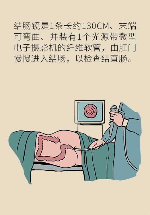 患潰瘍性結(jié)腸炎該怎么辦？結(jié)腸鏡檢查了解一下
