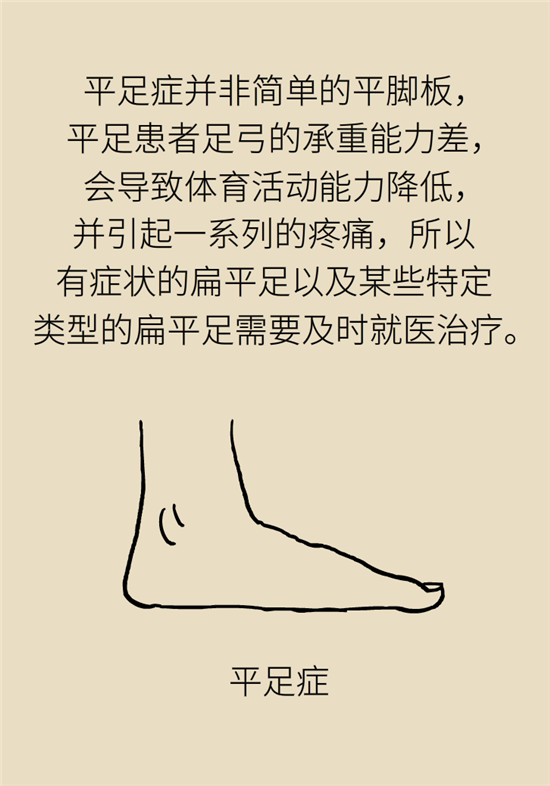 走幾百米路就疼得不行了？可能患上了平足癥