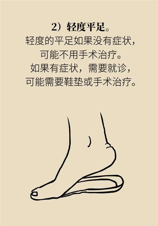 走幾百米路就疼得不行了？可能患上了平足癥