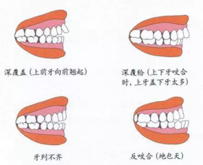 兒童換牙常見3大問題，保護(hù)牙齒需要做好這5點(diǎn)