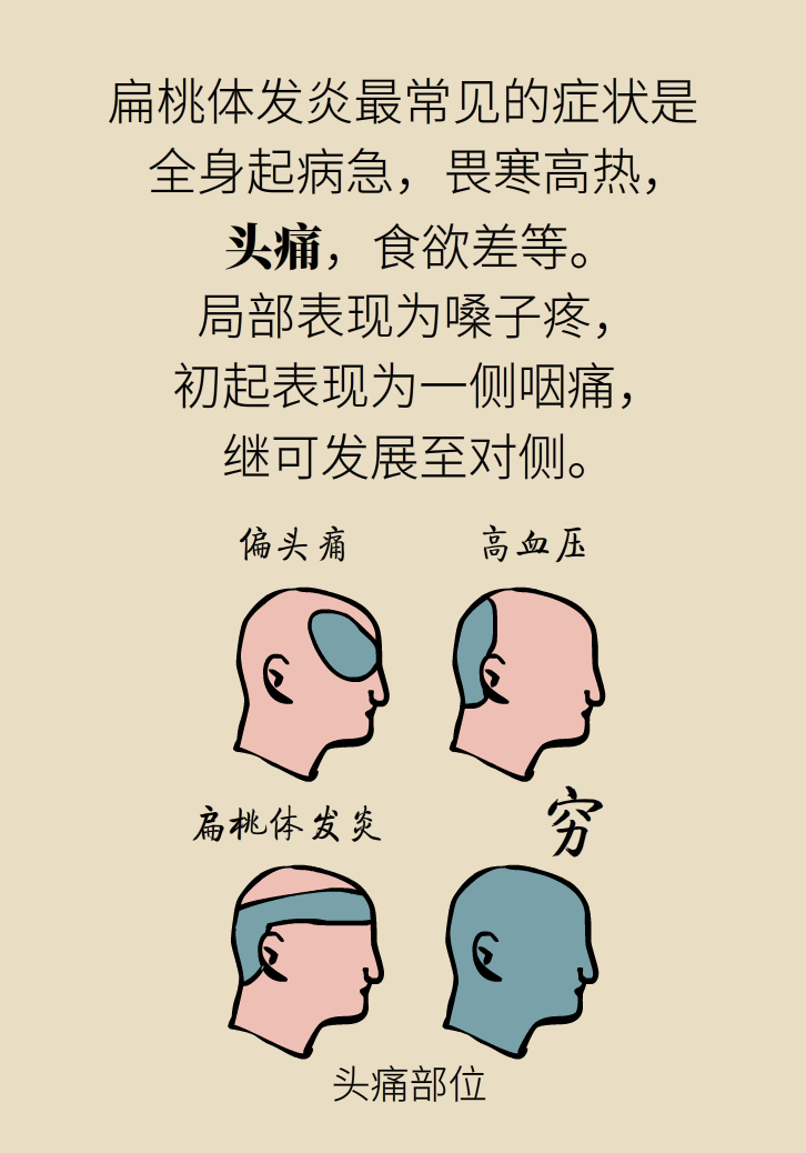 單側(cè)扁桃體腫大更兇險(xiǎn)！謹(jǐn)防惡性腫瘤