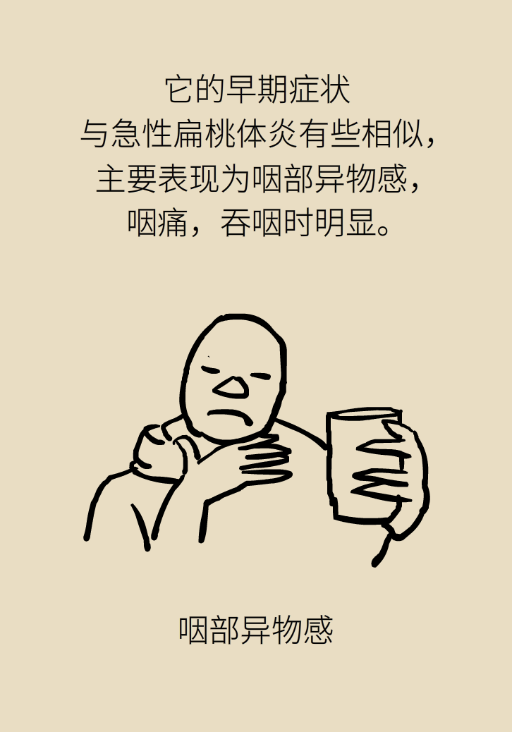 單側(cè)扁桃體腫大更兇險(xiǎn)！謹(jǐn)防惡性腫瘤
