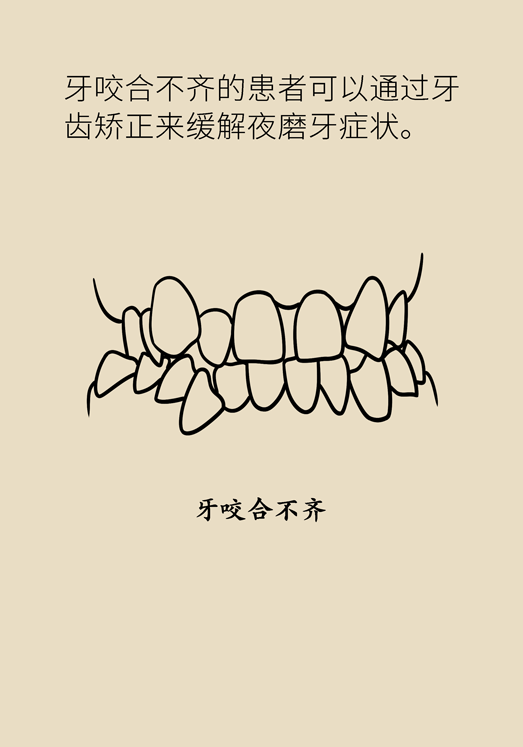 牙齒科普動(dòng)漫 磨牙
