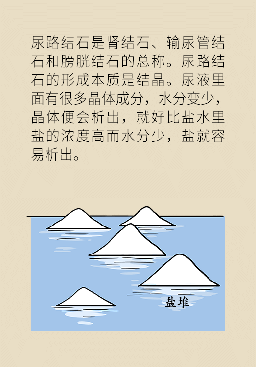 結石科普動漫制作 結石科普動漫制作