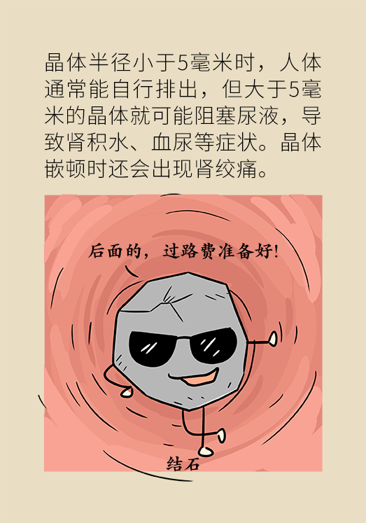 結石科普動漫制作 結石科普動漫制作