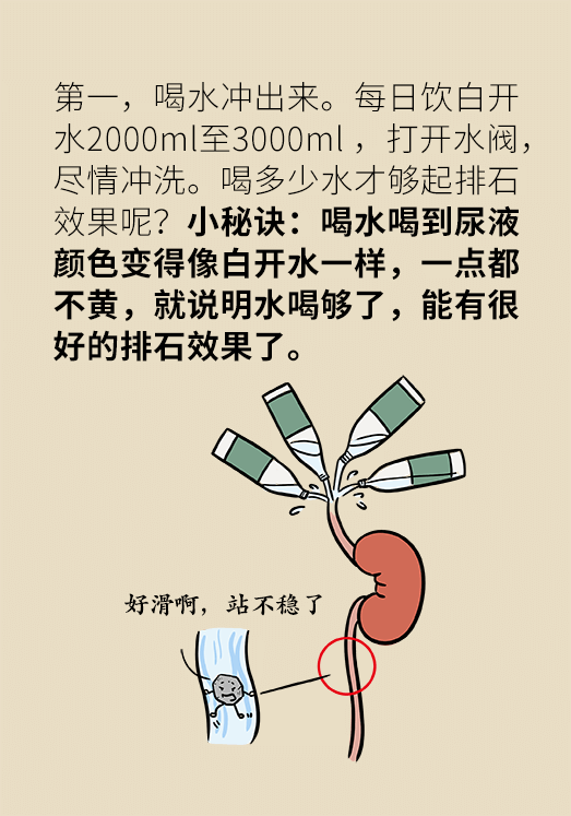 結石科普動漫制作 結石科普動漫制作