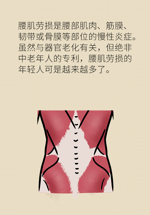 久坐久站致腰肌勞損？六招教你戰(zhàn)勝腰痛