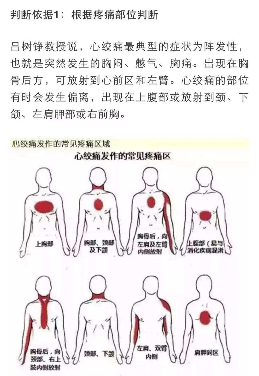 心梗有前兆！心臟發(fā)出的警報(bào)你在意了嗎？