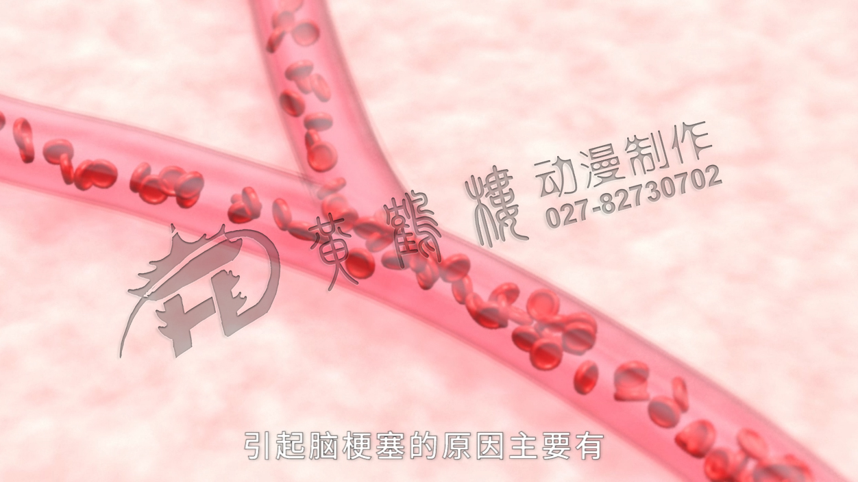 醫(yī)學(xué)動(dòng)畫宣傳片 醫(yī)學(xué)動(dòng)畫宣傳片