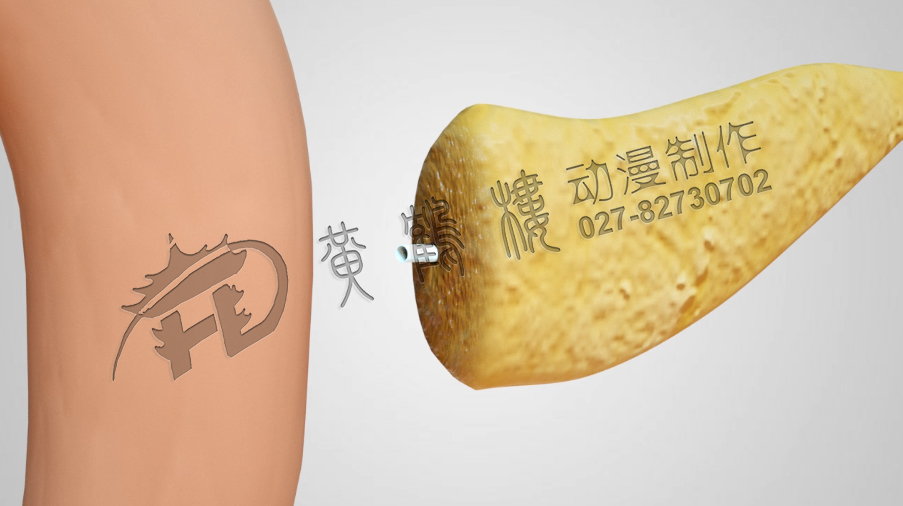 武漢醫(yī)療動(dòng)畫(huà)制作.jpg 武漢醫(yī)療動(dòng)畫(huà)制作.jpg