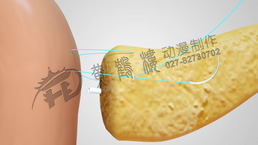 武漢醫(yī)學(xué)制作動(dòng)畫(huà)公司.jpg 武漢醫(yī)學(xué)制作動(dòng)畫(huà)公司.jpg