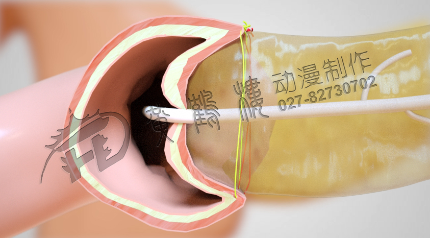 武漢制作醫(yī)療動(dòng)畫(huà)公司.jpg 武漢制作醫(yī)療動(dòng)畫(huà)公司.jpg