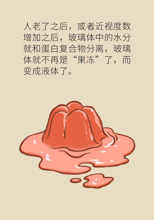 眼科醫(yī)學科普動漫