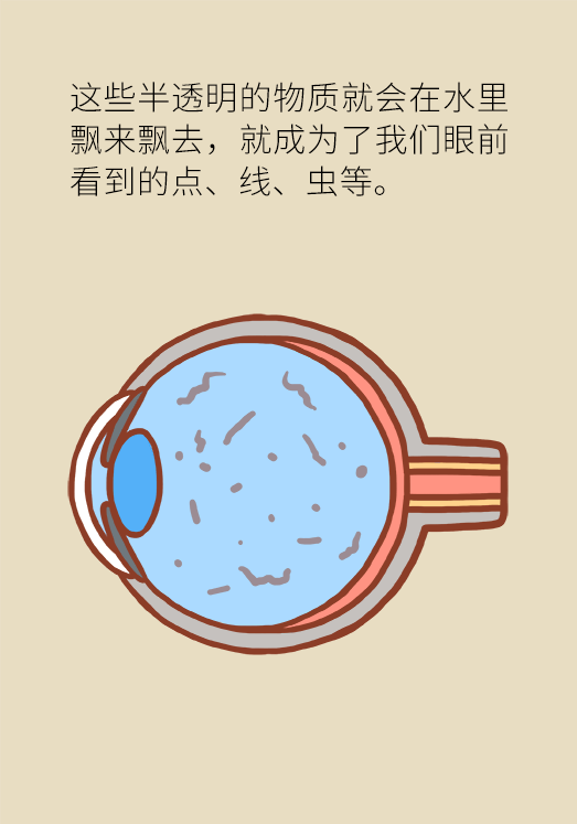 眼科醫(yī)學科普動漫