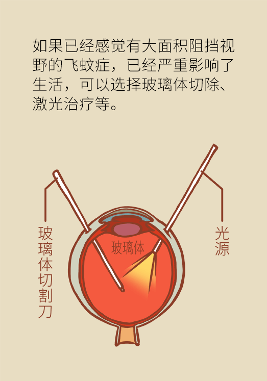 眼科醫(yī)學科普動漫