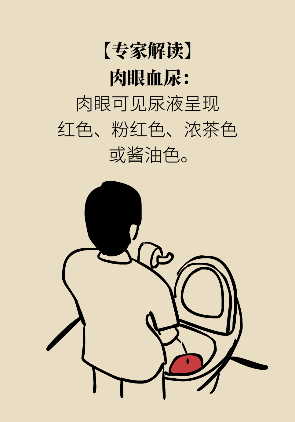 醫(yī)學腎知識科普
