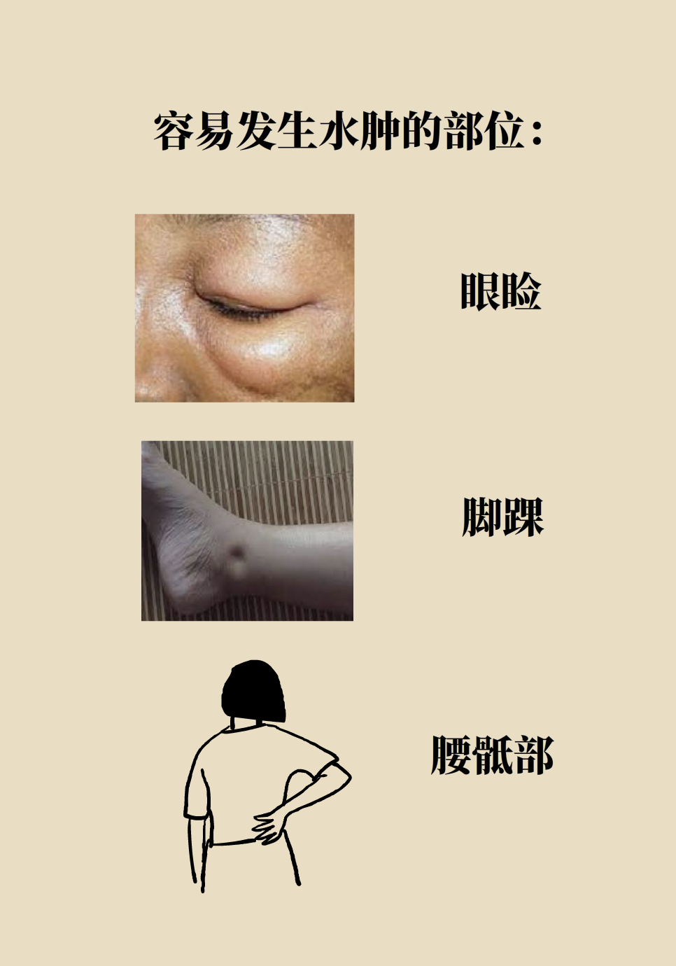 醫(yī)學腎知識科普