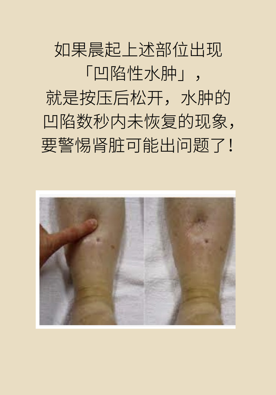 醫(yī)學腎知識科普