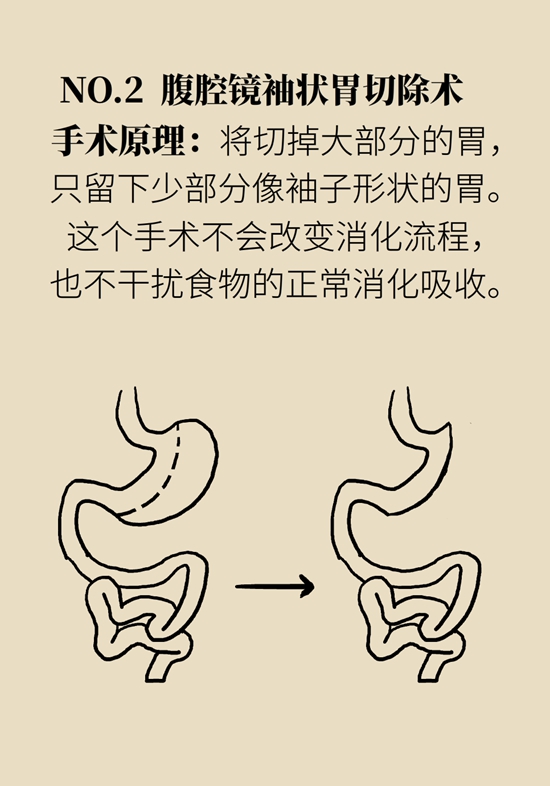 減肥醫(yī)學知識科普