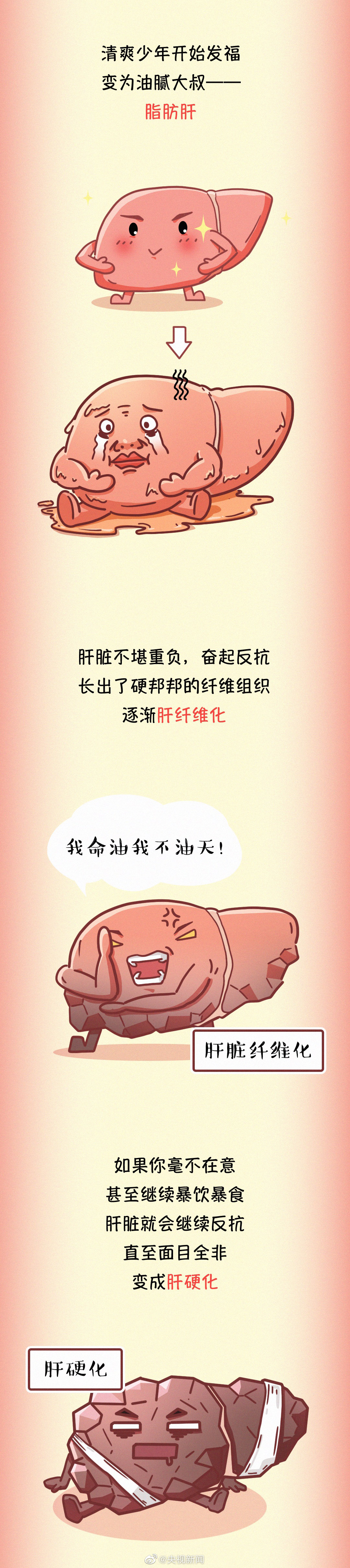 肝臟疾病醫(yī)學(xué)科普：常見傷肝行為有哪些？04.jpg
