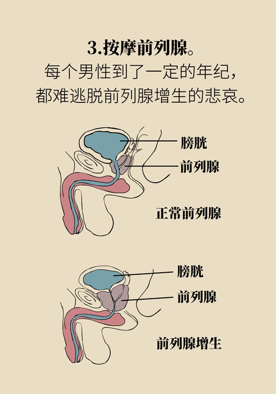 怎么做可以預(yù)防痔瘡呢？按摩前列腺、鍛煉盆底肌