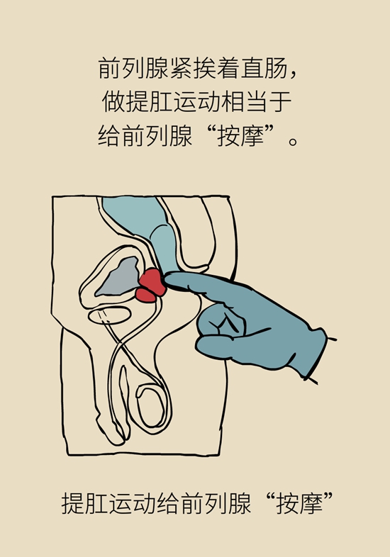 怎么做可以預(yù)防痔瘡呢？按摩前列腺、鍛煉盆底肌