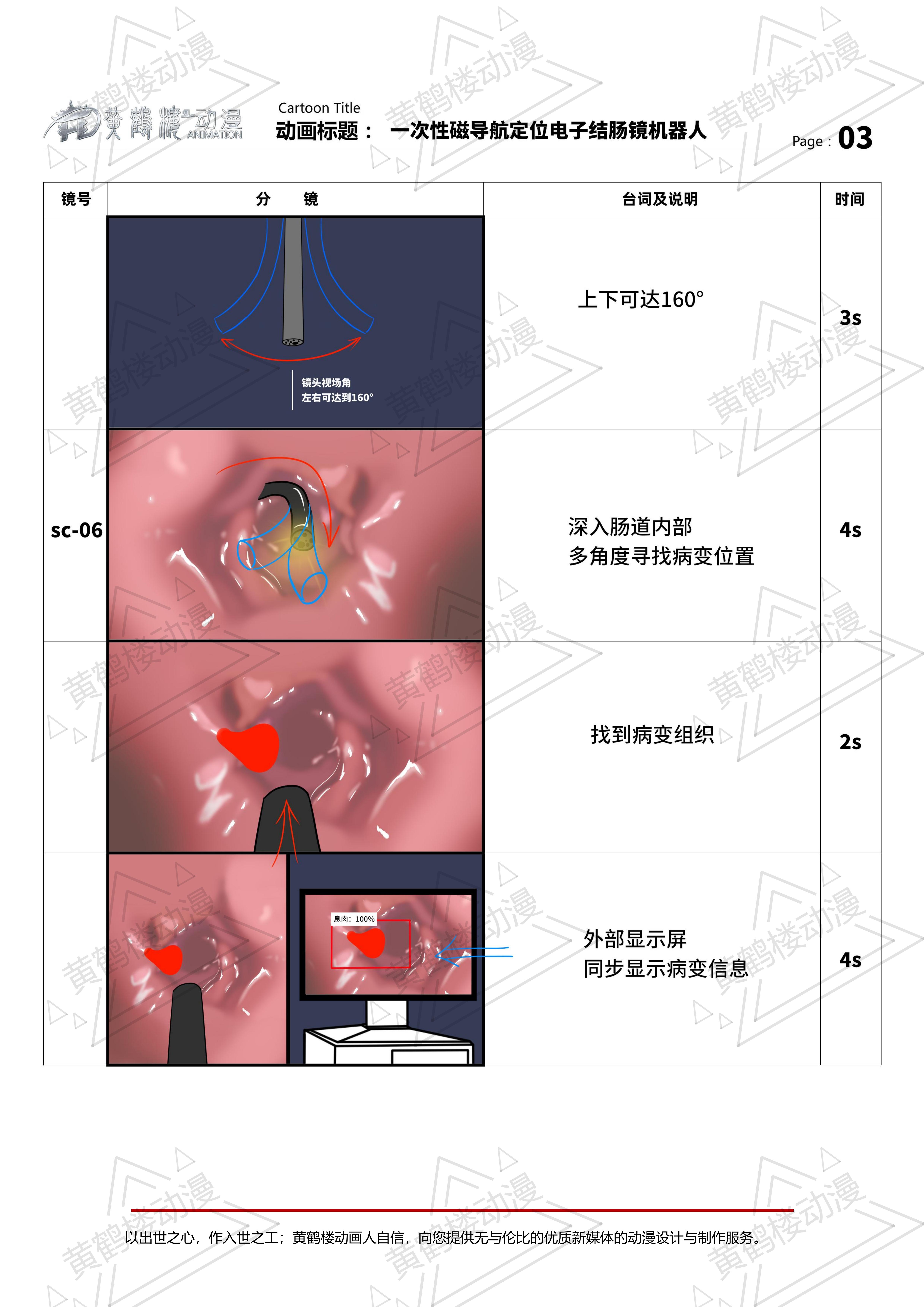 一次性磁導(dǎo)航定位電子結(jié)腸鏡機(jī)器人三維動(dòng)畫分鏡210514_02.jpg